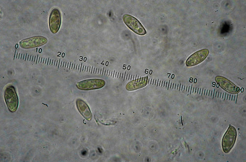Aureoboletus gentilis spores Aureoboletus gentilis spores