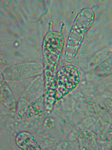 Basidia unstained Basidia unstained