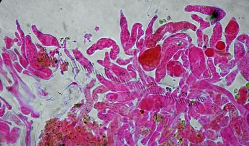 Boletus poikilochromus caulocystidia Boletus poikilochromus caulocystidia