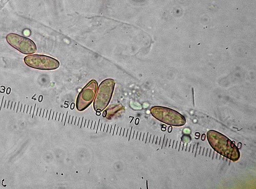 Boletus poikilochromus spores Boletus poikilochromus spores
