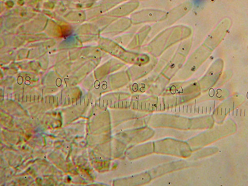 Cuticle prepararation Cuticle preparation