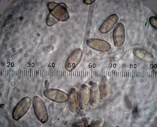 Xerocomus persicolor spores Xerocomus persicolor spores