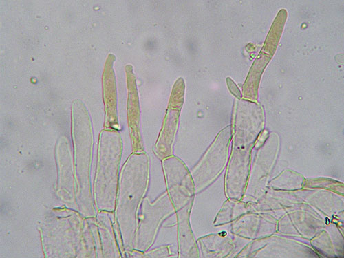 Xerocomus subtomentosus Xerocomus subtomentosus
